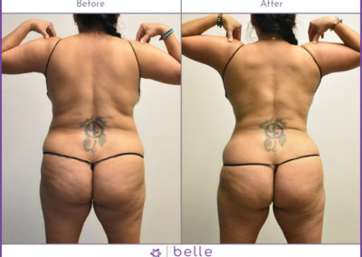 BM-WOC-Back-Before-After